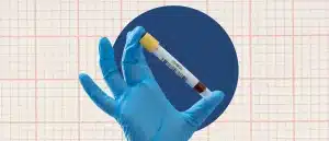 A blue gloved hand holds a vial of blood indicating SHBG levels on the label