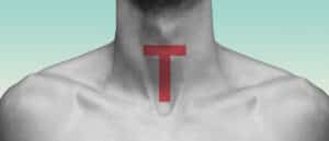 A "T for testosterone, placed over a man's neck where his thyroid sits