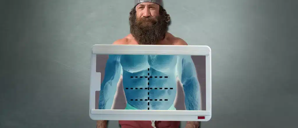 Liver King standing in front of x-ray screen