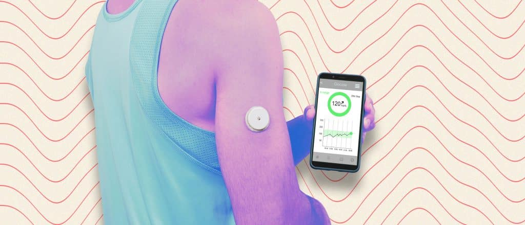 man wearing a continuous glucose monitor on his arm and holding his phone which shows his real time blood glucose level.
