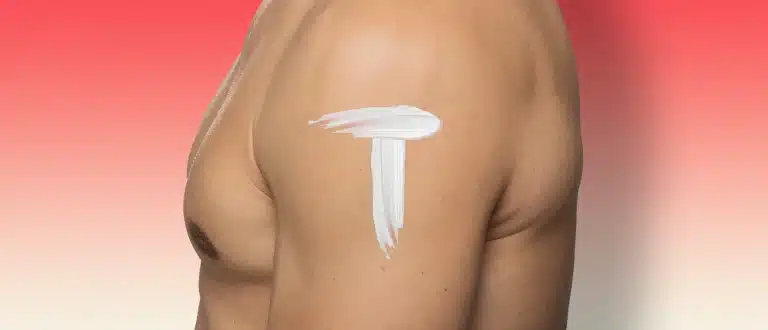 Man standing with testosterone cream is shape of T on shoulder
