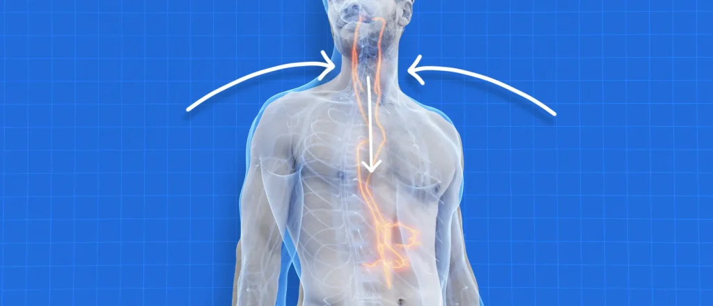 A diagram of vagus nerve stimulation